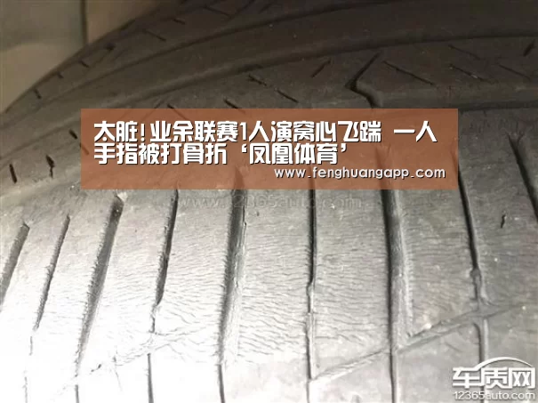 太脏!业余联赛1人演窝心飞踹 一人手指被打骨折‘凤凰体育’(图1) 凤凰体育官网入口